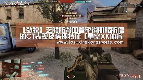 【弘锐】乏脂肪肾血管平滑肌脂肪瘤的CT表现及病理特征【星空XK体育】(图2) 【弘锐】乏脂肪肾血管平滑肌脂肪瘤的CT表现及病理特征【星空XK体育】(图2)