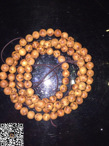 【弘锐】乏脂肪肾血管平滑肌脂肪瘤的CT表现及病理特征【星空XK体育】(图4) XK体育